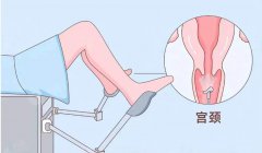 成都锦江妇幼提示：预防宫颈癌，HPV、TCT检查很重要！